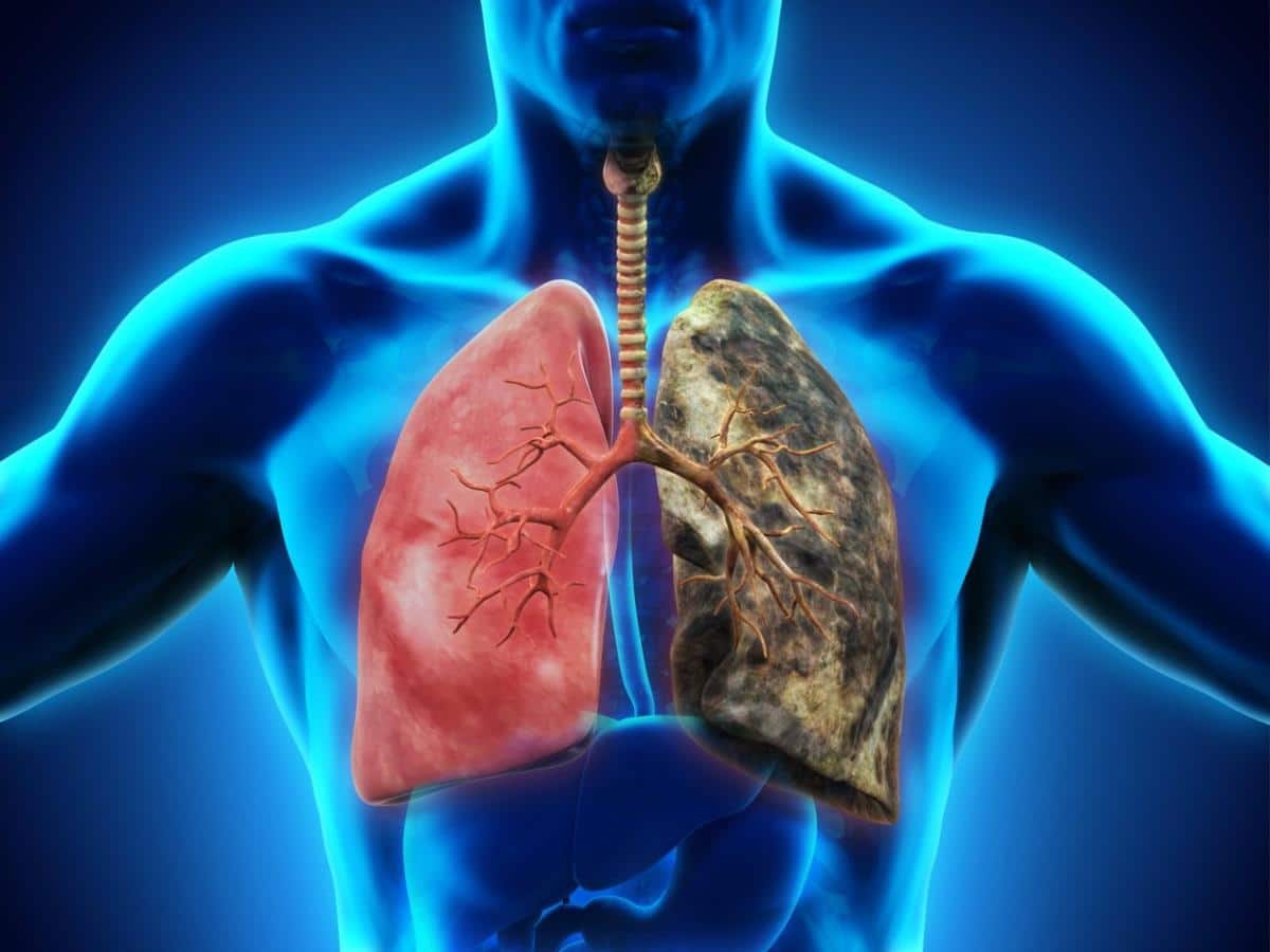 Popularni test otkriće kakva su vam pluća: Ako možete ovo da uradite, kapacitet vam je kao kod vojnika