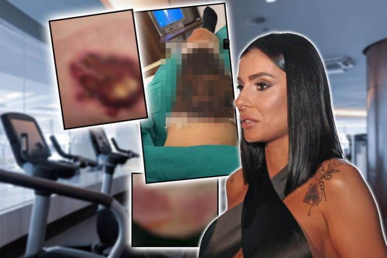 MIA UPLETENA U AFERU SA JEZIVIM ISHODOM Žena tvrdi da je posle tretmana završila u bolnici zbog prženja kože, pevačica odgovara: Salon nije moj, to je IZNUDA!
