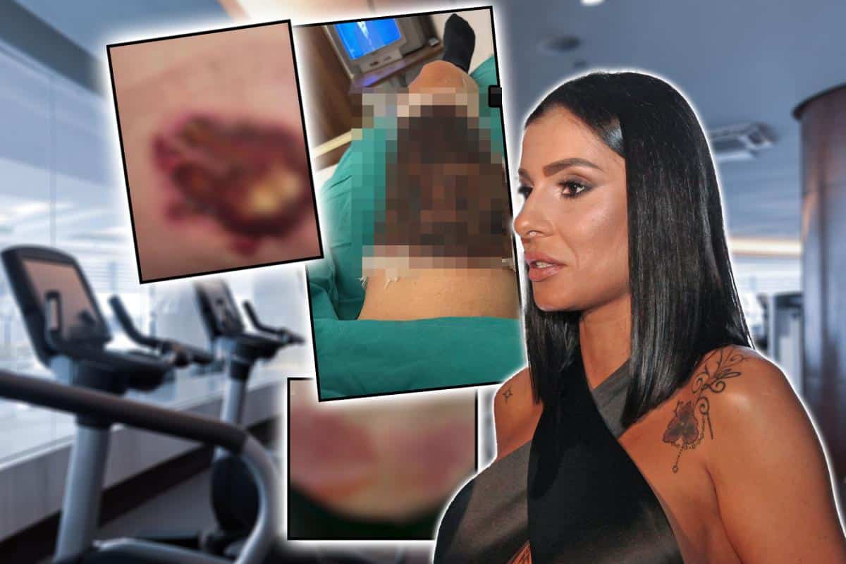 MIA UPLETENA U AFERU SA JEZIVIM ISHODOM Žena tvrdi da je posle tretmana završila u bolnici zbog prženja kože, pevačica odgovara: Salon nije moj, to je IZNUDA!