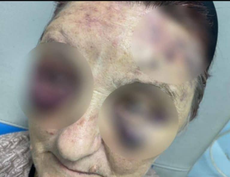 “MOGLI STE SAMO DA ME ZAMOTATE U ČARŠAV I NOSITE U GROB”: Ženu iz Živinaca muž  tukao skoro 50 godina, ona ćutala: Evo šta je bio okidač da konačno progovori