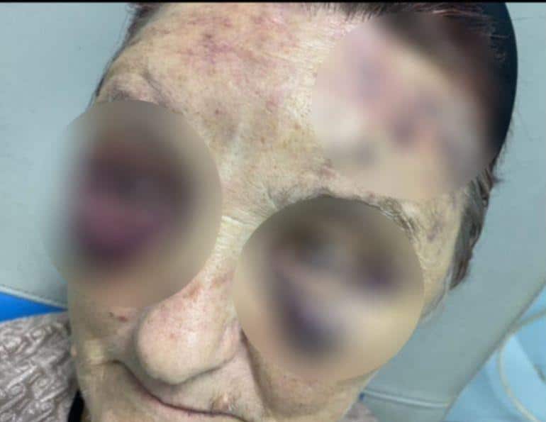 “MOGLI STE SAMO DA ME ZAMOTATE U ČARŠAV I NOSITE U GROB”: Ženu iz Živinaca muž tukao skoro 50 godina, ona ćutala: Evo šta je bio okidač da konačno progovori